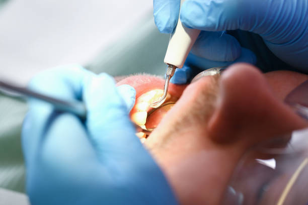 Best Emergency Dental Extractions in Chinchilla, PA